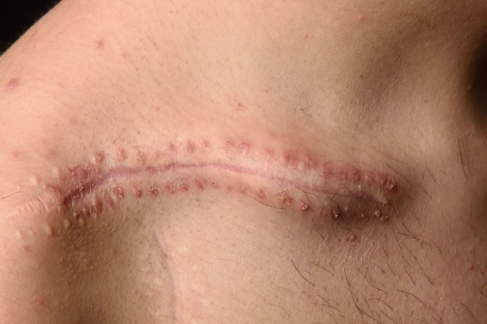 Blog Post Image