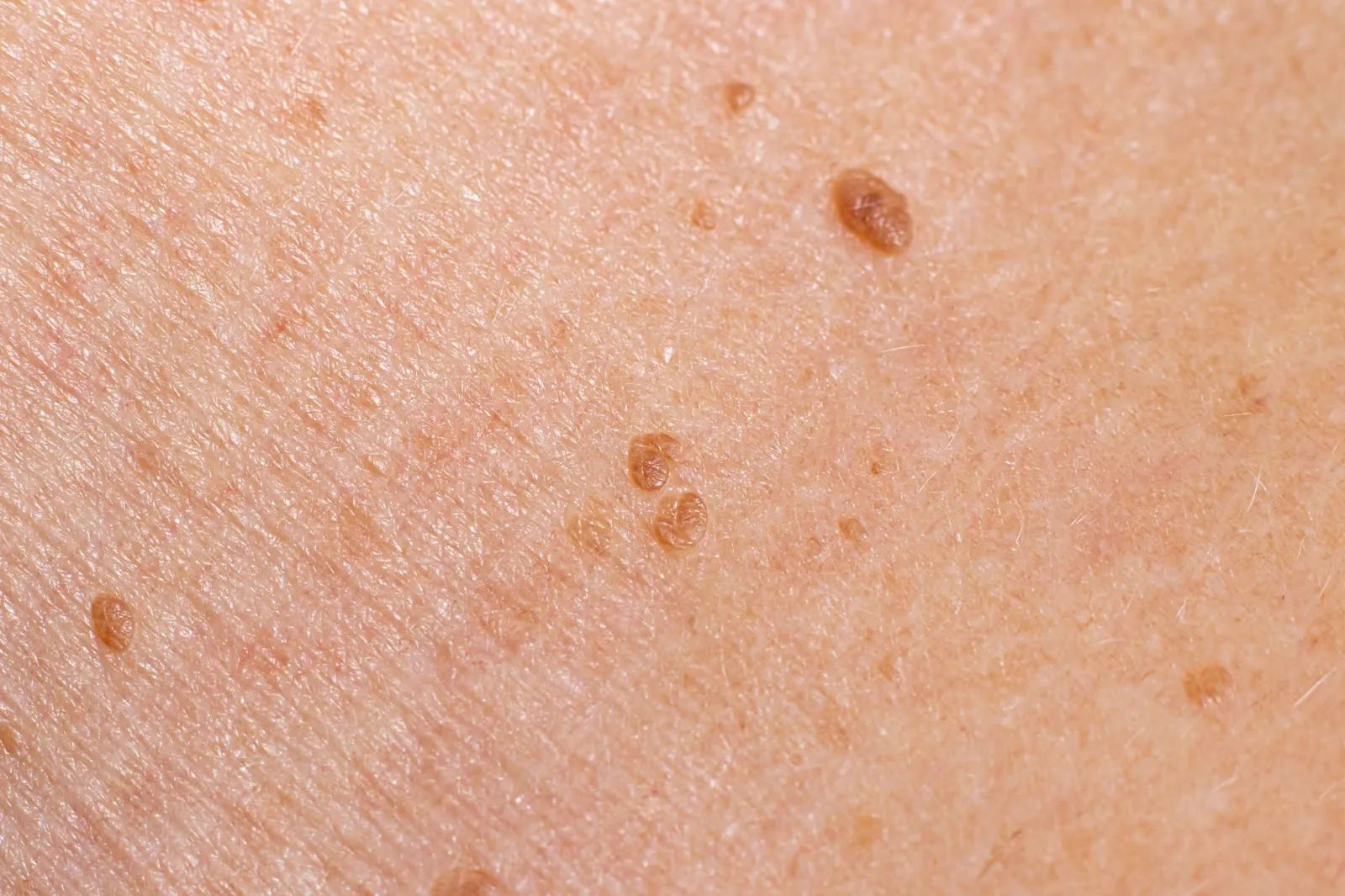 Blog Post Image