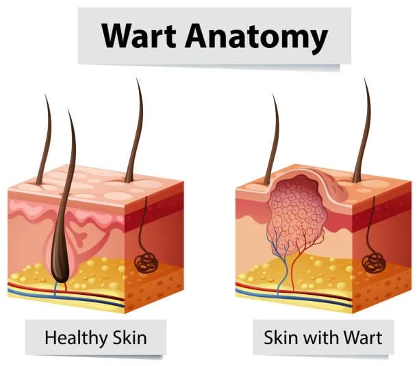 Blog Post Image