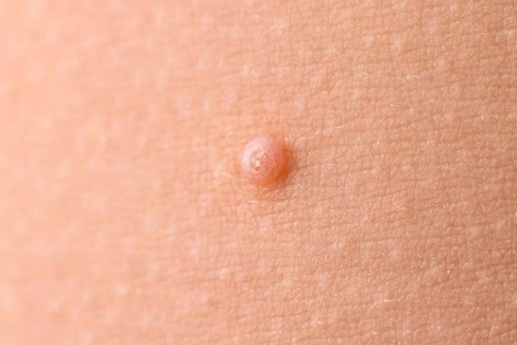 Blog Post Image