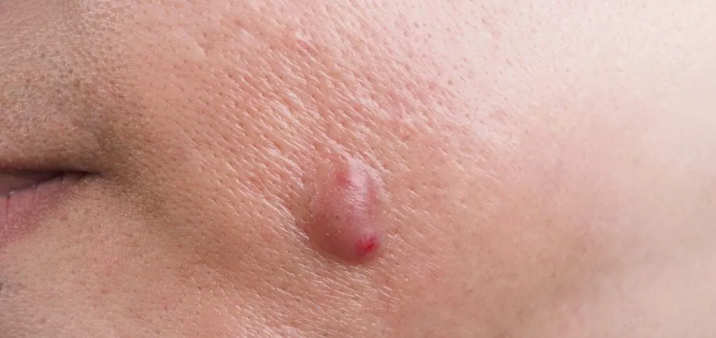 Blog Post Image
