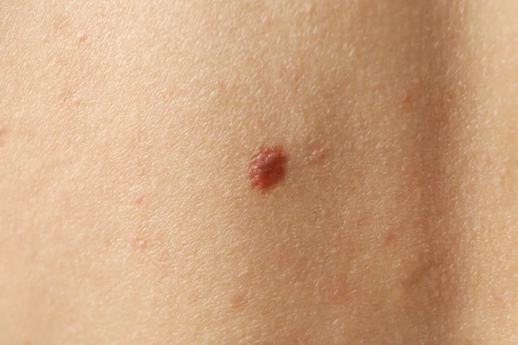 Blog Post Image